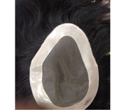 Monofilament Hair Patch